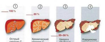 Xroniki hepatit: nədir, müalicəsi, simptomları, səbəbləri, əlamətləri